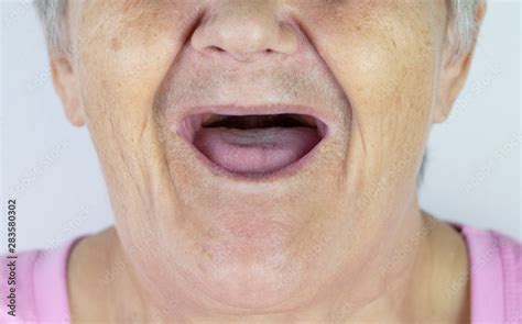 old lady with no teeth|175 Toothless Old Lady Stock Photos & High.